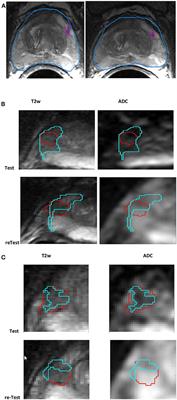 Repeatability of Quantitative Imaging Features in Prostate Magnetic Resonance Imaging